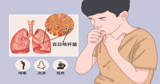 咳咳咳!小孩咳嗽,家长不要慌,这份指南请收好